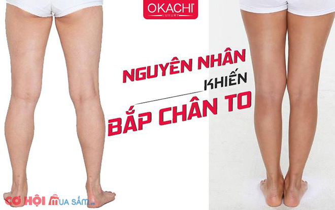 Mách bạn cách khắc phục bắp chân to trở nên thon gọn đơn giản - Ảnh 1